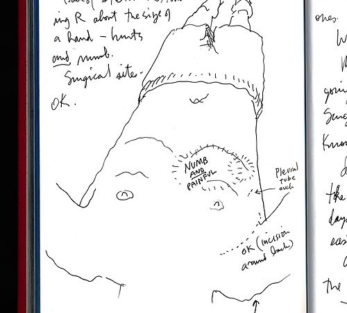 "My map of discomfort."